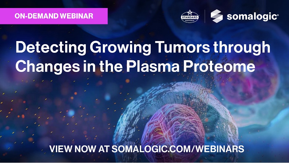 SomaLogic (@somalogic) on Twitter photo 🔬 Watch now! In our latest on-demand webinar, learn more about tumor detection in the plasma proteome with Dr. Nebojsa Janjic. Explore groundbreaking research published in a Top 100 downloaded cancer paper from <a href="/SciReports/">Scientific Reports</a>. somalogic.com/webinar/detect…
#TumorDetection #PlasmaProteome 🔬 Watch now! In our latest on-demand webinar, learn more about tumor detection in the plasma proteome with Dr. Nebojsa Janjic. Explore groundbreaking research published in a Top 100 downloaded cancer paper from <a href="/SciReports/">Scientific Reports</a>. somalogic.com/webinar/detect…
#TumorDetection #PlasmaProteome