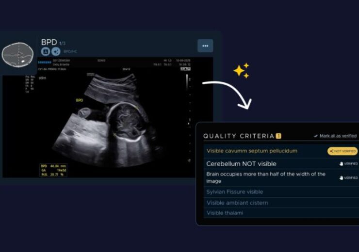 Samsung Medison's Acquisition of Sonio: A Strategic Move in the Healthcare AI Market

#Acquisition #AI #artificialintelligence #Autonomy #FDAclearance #globalpresence #Growthpotential #gynecologists #Healthcare #imagingworkflows #llm #machinelearning
multiplatform.ai/samsung-mediso…