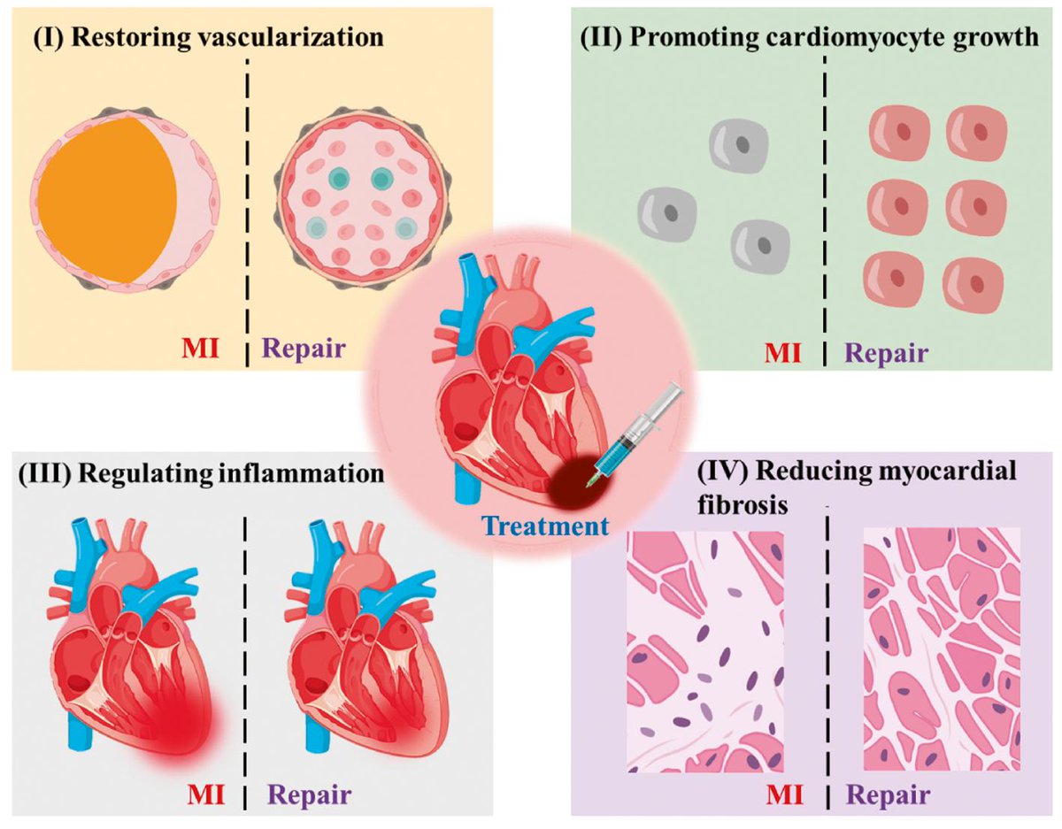 🔴Overview of Injectable Hydrogels for the Treatment of Myocardial Infarction #openaccess #2024Review 

scienceopen.com/hosted-documen…
#Cardiology #meded #medtwitter #medical #cardiology #CardioTwitter #CardioEd