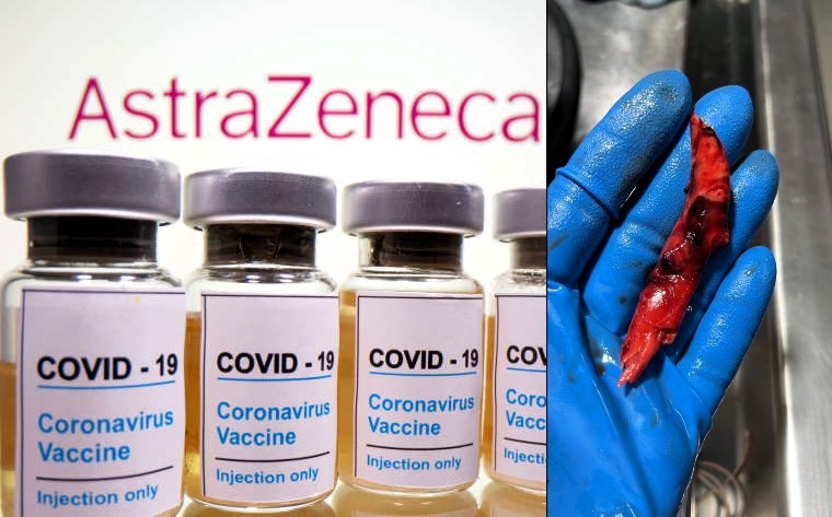 Breaking News: AstraZeneca to Withdraw COVID Vaccine Globally – The Fall of a Pandemic Titan AstraZeneca has pulled the plug on its once-celebrated COVID-19 vaccine, Vaxzevria. The company cites a steep decline in market demand as its reason, yet lurking beneath the surface are