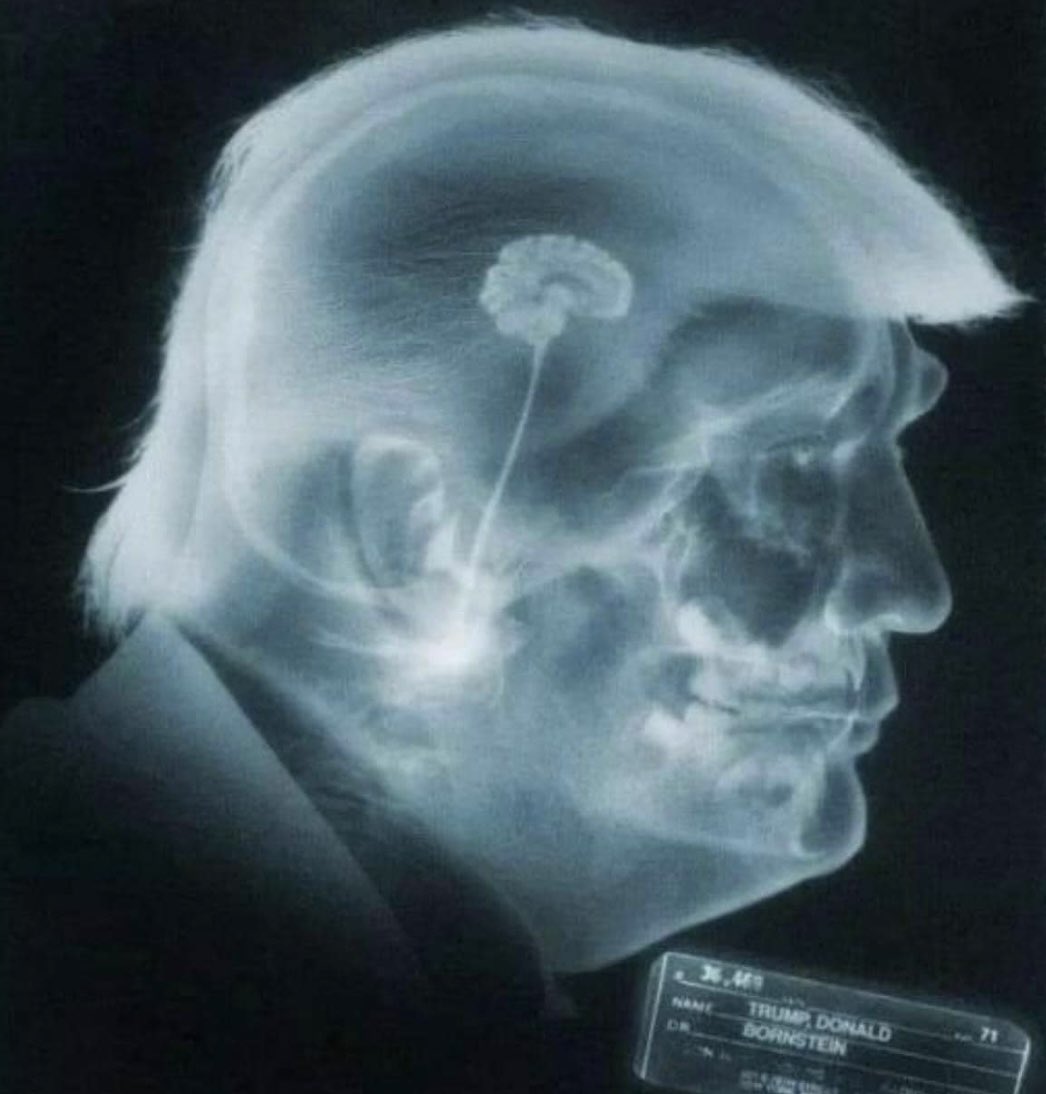 “I was tested for brain worms at Walter Reed. The doctors were passing around my X-rays because nobody’s ever seen such a bigly brain before.”