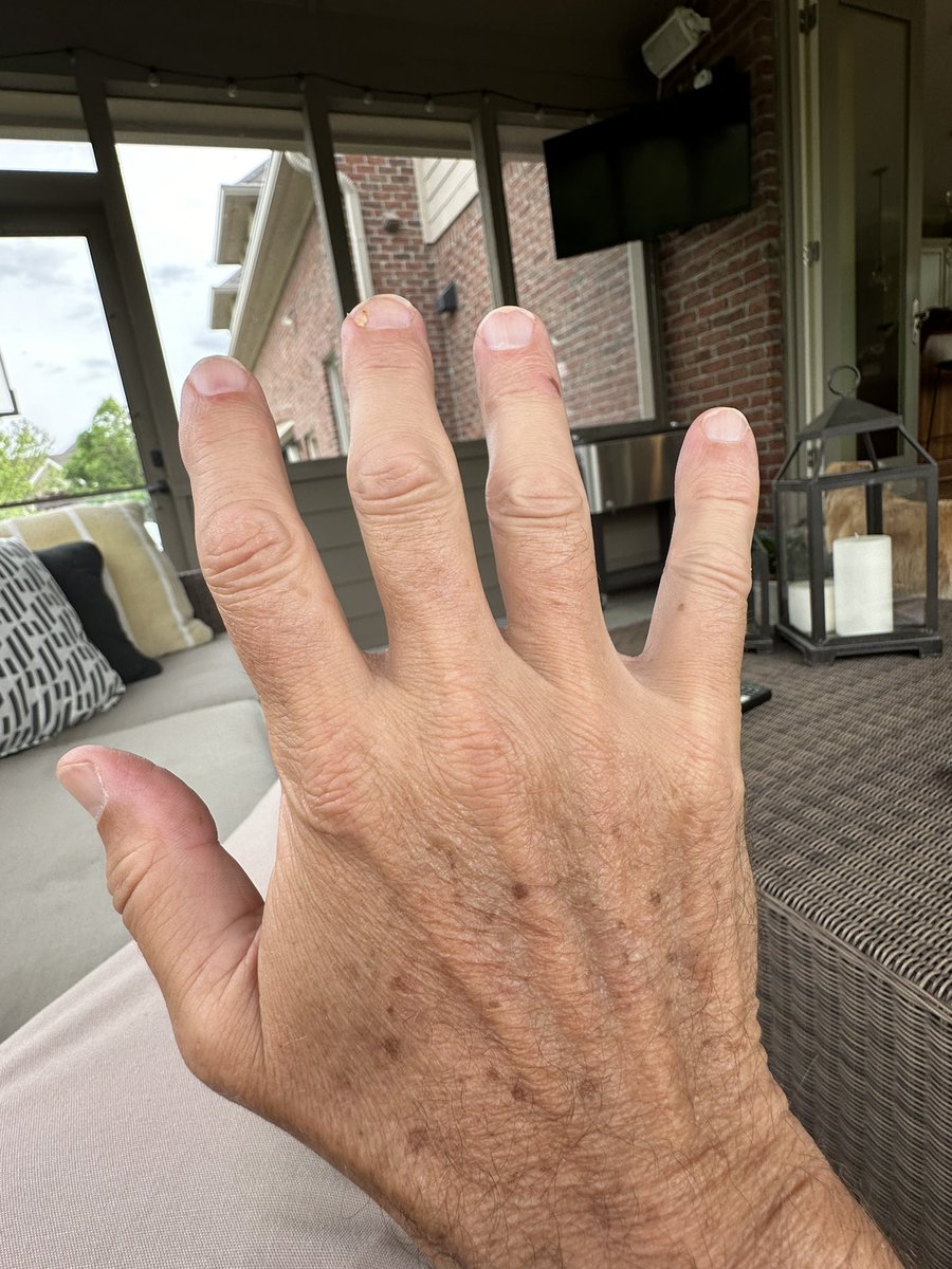 pjamiesonkay's tweet photo. An anatomy refresher prior to tonight’s game 2. 
@nba @NBAOfficial @Pacers 
This is a hand.              This is a foot. https://t.co/BorIcXuKO3