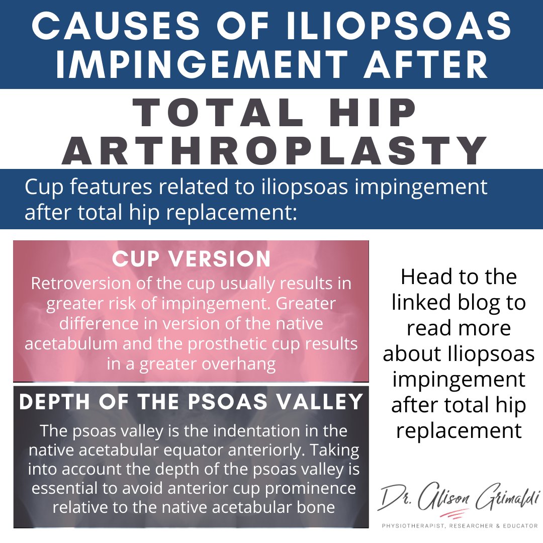 Last week, we explored 2 acetabular cup factors affecting iliopsoas impingement post-hip replacement: size and inclination. Now, let's examine 2 more: cup version and psoas valley depth. Learn about symptoms, causes, and treatments here: dralisongrimaldi.com/blog/iliopsoas…