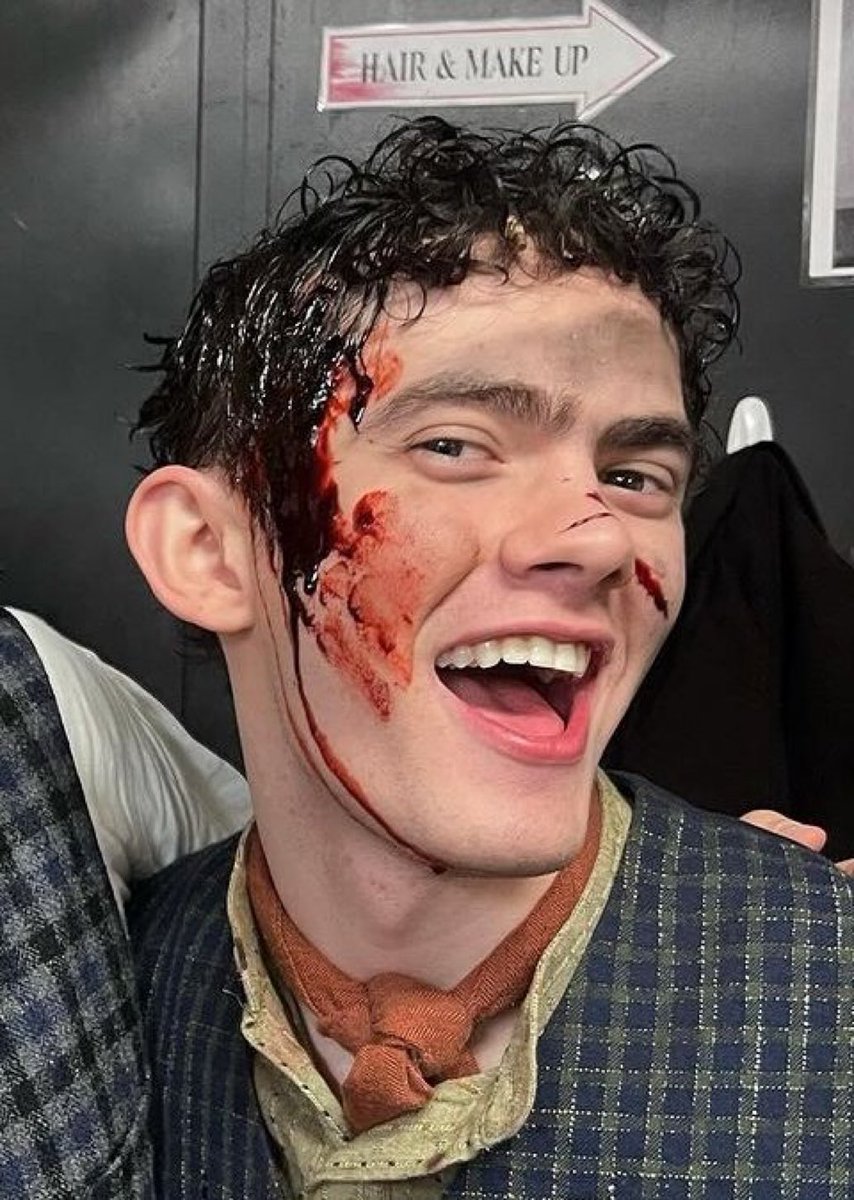 how is he stunning covered in blood ???
