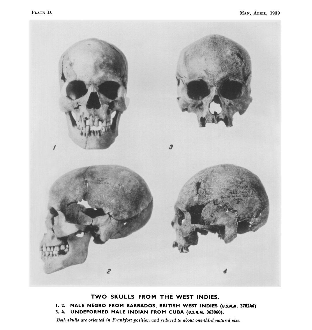 Two Negro male skeletons found in the US Virgin Islands by the Smithsonian team dating back to 1250 AD in PRE COLUMBIAN TIMES!

#BlackAmericans #BlackIndians #NativeAmerican #BlackNativeAmericans #IndigenousPeoples #FBA #westindian #WestIndies
 nytimes.com/1975/12/04/arc….