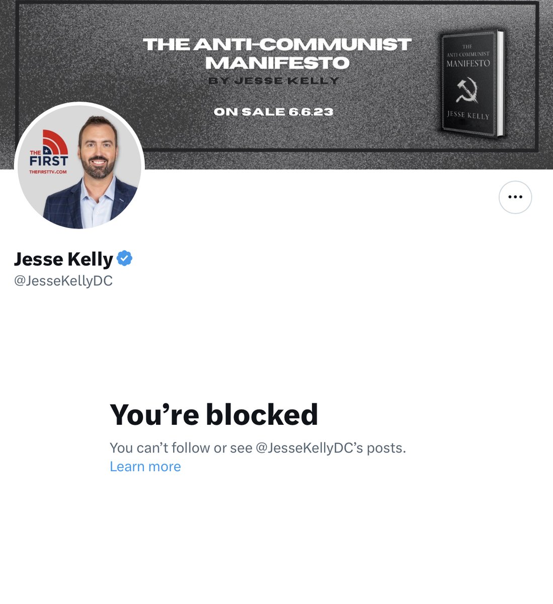 Jesse Kelly just Blocked me, What a Baby he is.