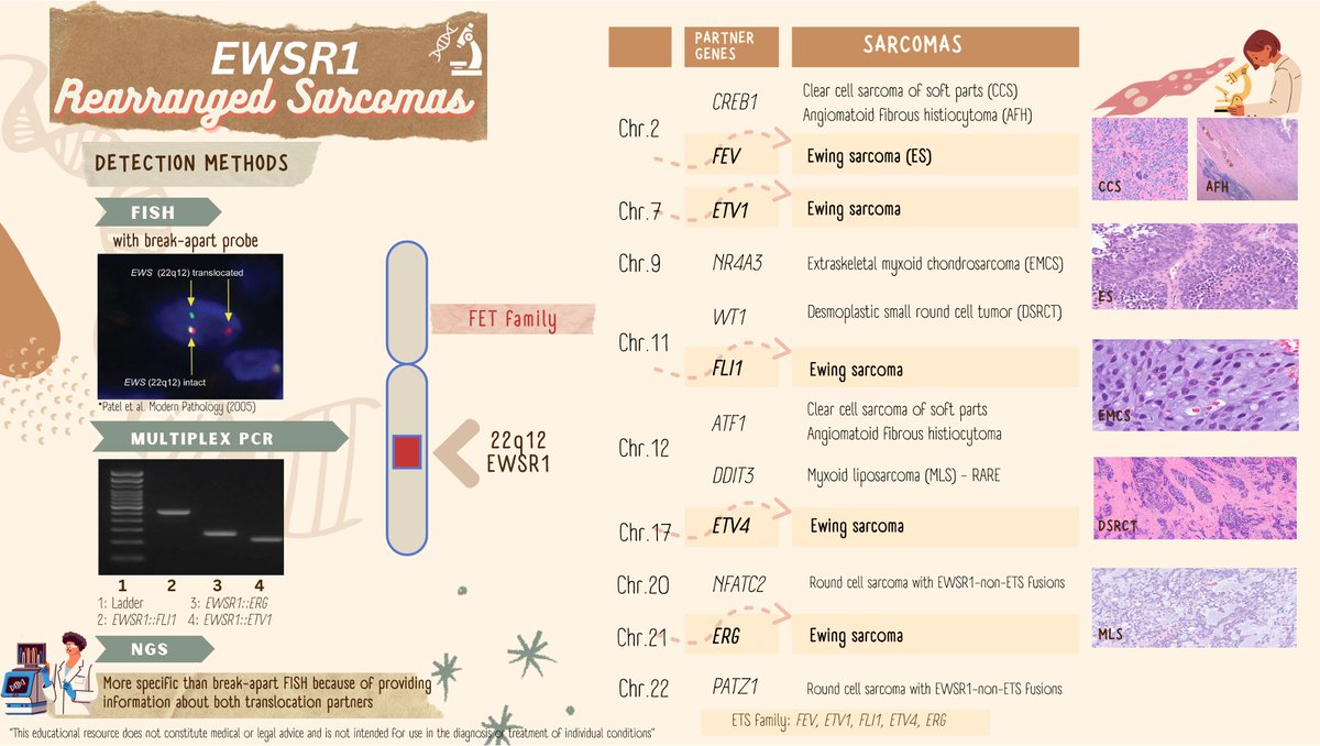 Stay informed about EWSR1-rearranged sarcomas for accurate diagnosis &amp; management! 

#MolecularPathology #BSTpath #AMPtutorials
