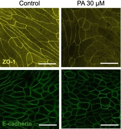 Investigators assessed the multifaceted 💬 interactions between palmitic acid, cell proliferation, and the intestinal epithelial barrier using a 🐕 canine colonoid model, as they offer a unique platform to explore mechanisms of #intestinal dysfunction. 👉 bit.ly/3UwUwhn