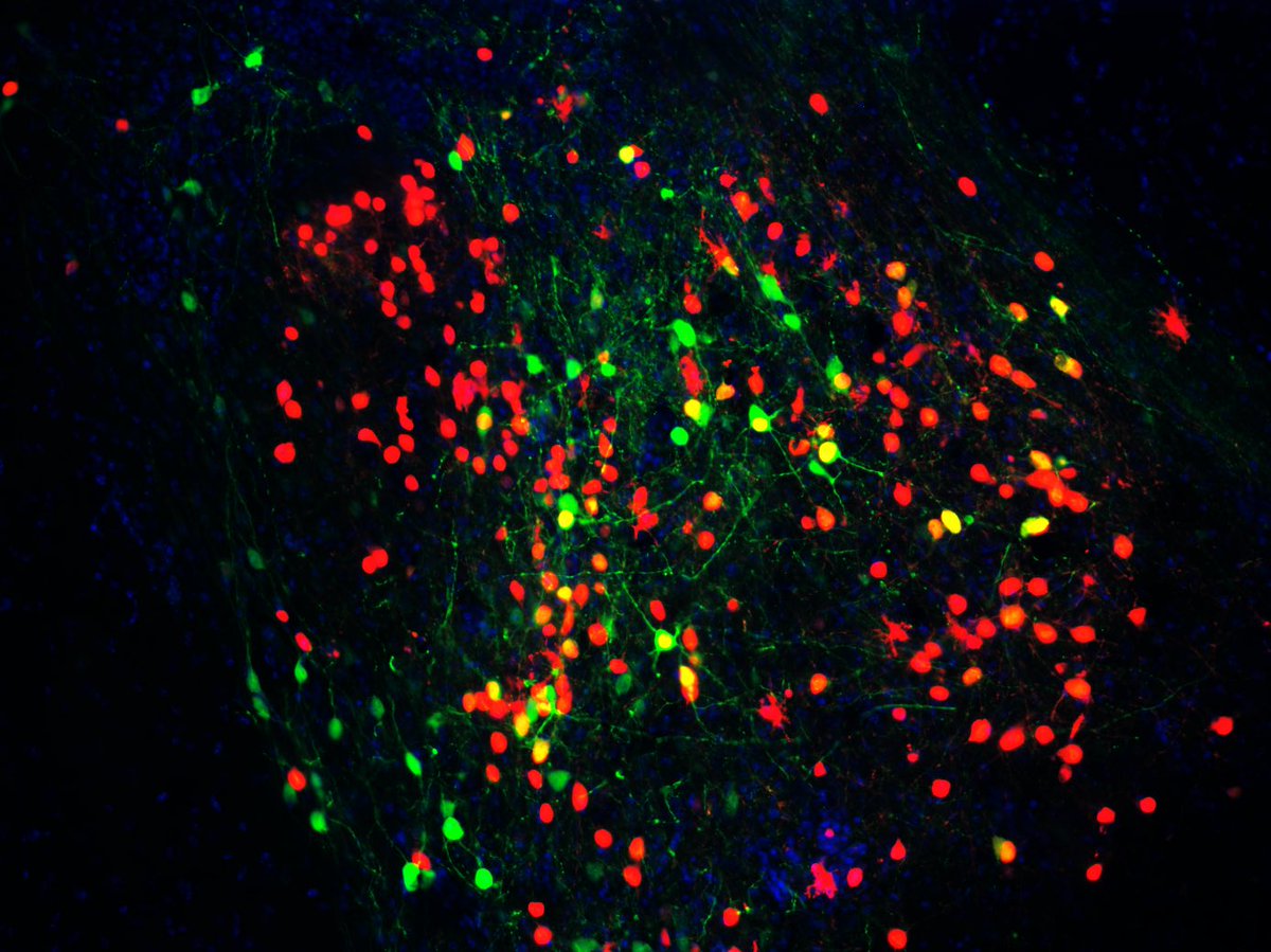 Neurons in the central amygdala just threw the ultimate glow-up party! They brighthened my day 🎉🧠  
Image credit: <a href="/LizzieGodschall/">Lizzie</a>