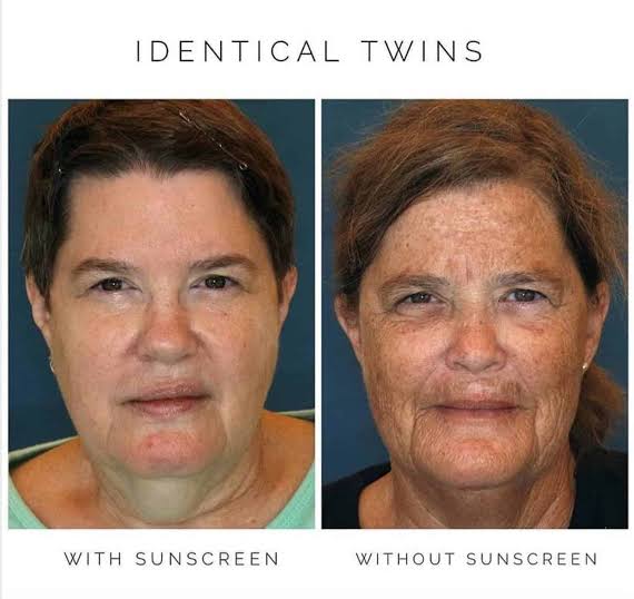 Sunscreen itu produk wajib yang gak bisa banget diskip. Ibaratnya, percuma perawatan pake produk semahal apapun kalo gak pake sunscreen. Gak percaya? Ini buktinya 👇 

#reviewbyLima #skincareproducts