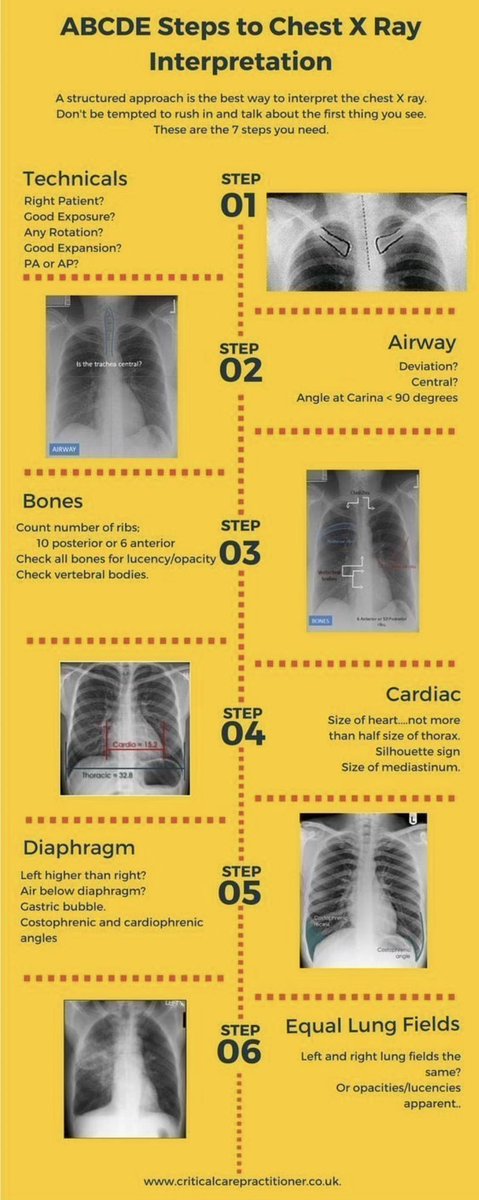 📌 ABCDE Steps to Chest X Ray
Interpretation. 

#FOAMed #MedEd #MedTwitter #medicalstudent #medicalpractis #Emergency #emergencymedicine 
#medicaleducation #radiology #CXR