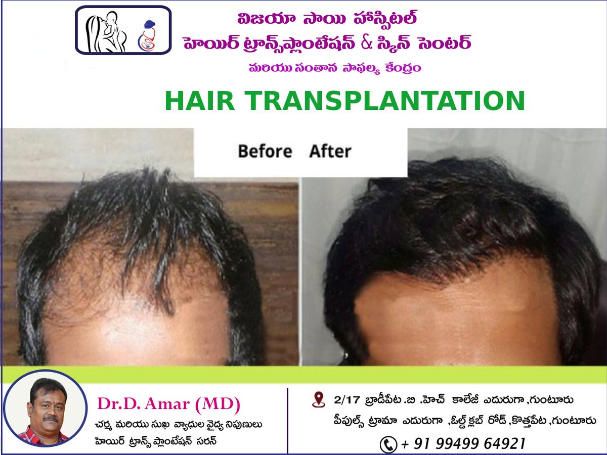 Best Hair Transplantation Center in Vijayawada 
Book An Appointment
📞 9949964921
#vijayaasaihospital #besthospitalinbrodipet #hairtransplantation
#hairtransplantation #bestdoctor #Dramar
#besthospitalinguntur #bestdoctornearme #Dramar