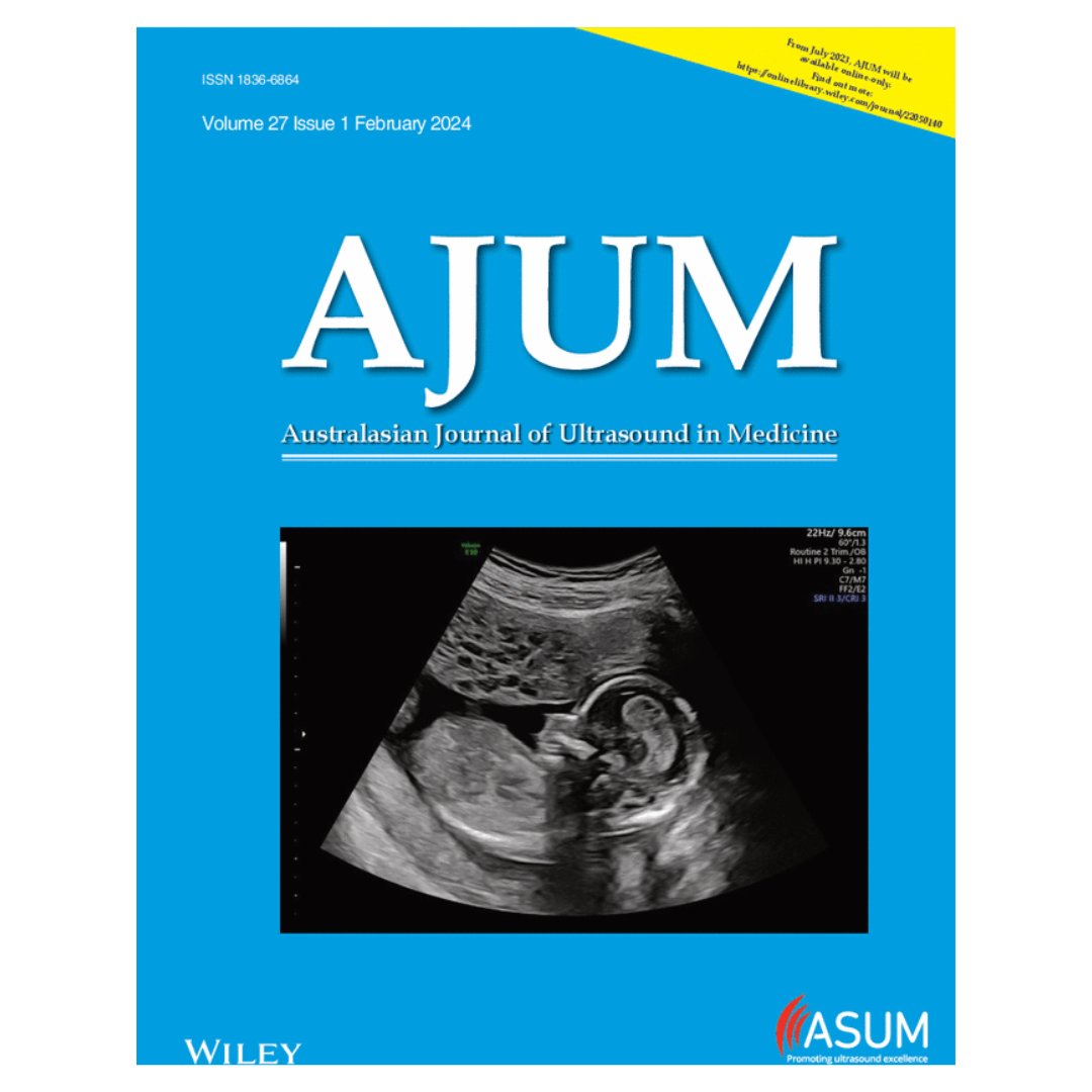 POCUS for Diagnosing Acute Cholecystitis in ED: Alexander Joyce et al. explore the accuracy and utility of point-of-care ultrasound in the emergency department for acute cholecystitis. How does it measure up?

Find out here ow.ly/u0oA50QPQhU