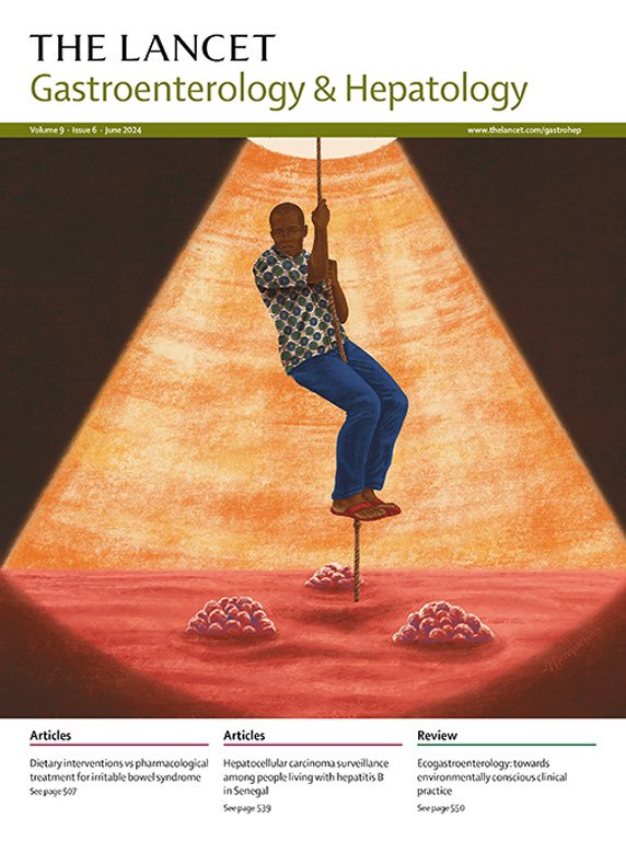 Our June issue is out now at thelancet.com/gastrohep! Content: management of IBS, loss of response to anti-TNF in Crohn’s, HCC surveillance in Africa, the environmental impact of gastroenterology, liver transplant for ACLF, MASLD, viral hepatitis + more #GITwitter #LiverTwitter