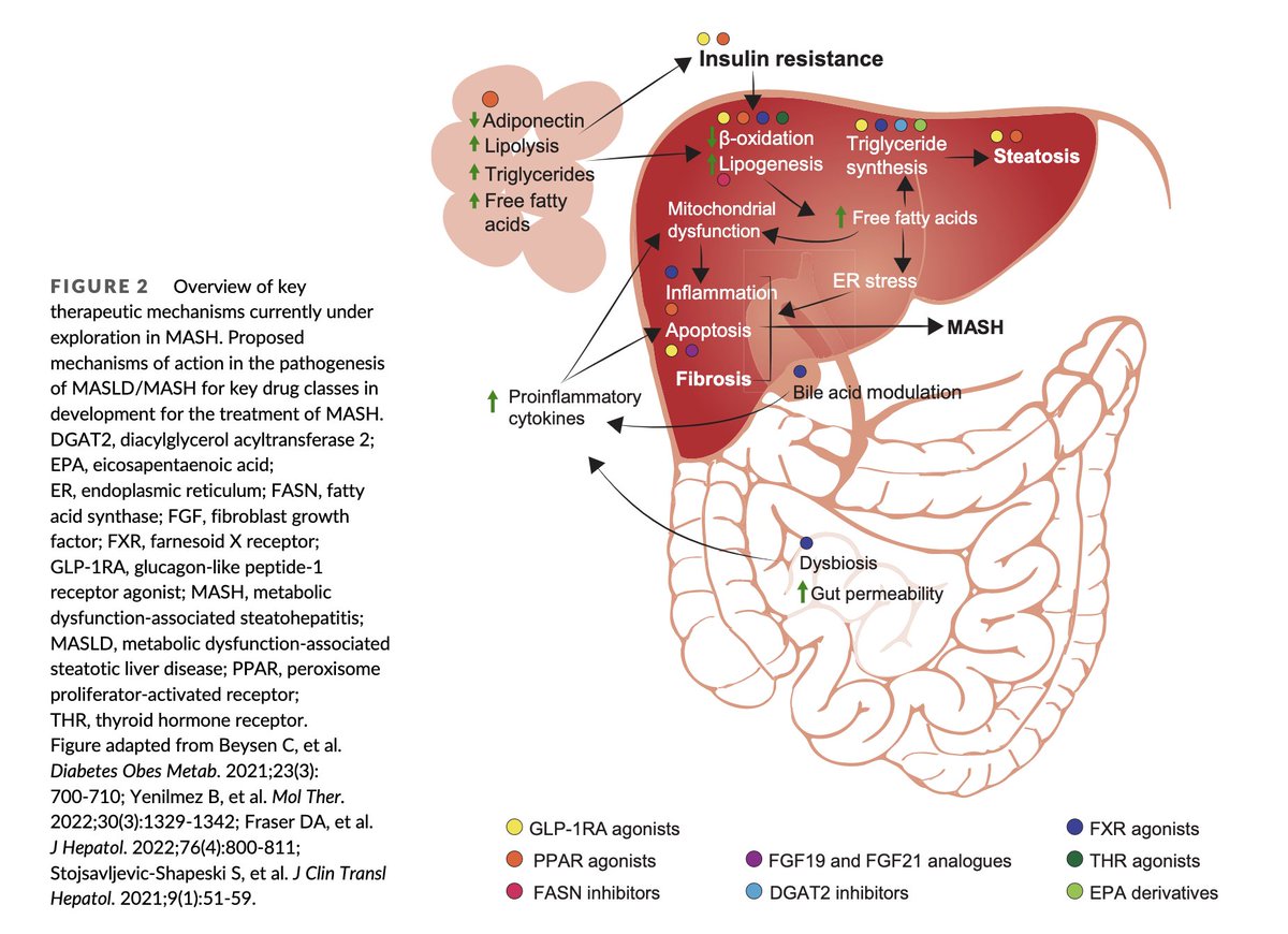 Review The role of glucagon-like peptide-1 receptor agonists in metabolic dysfunction-associated steatohepatitis dom-pubs.onlinelibrary.wiley.com/doi/full/10.11…