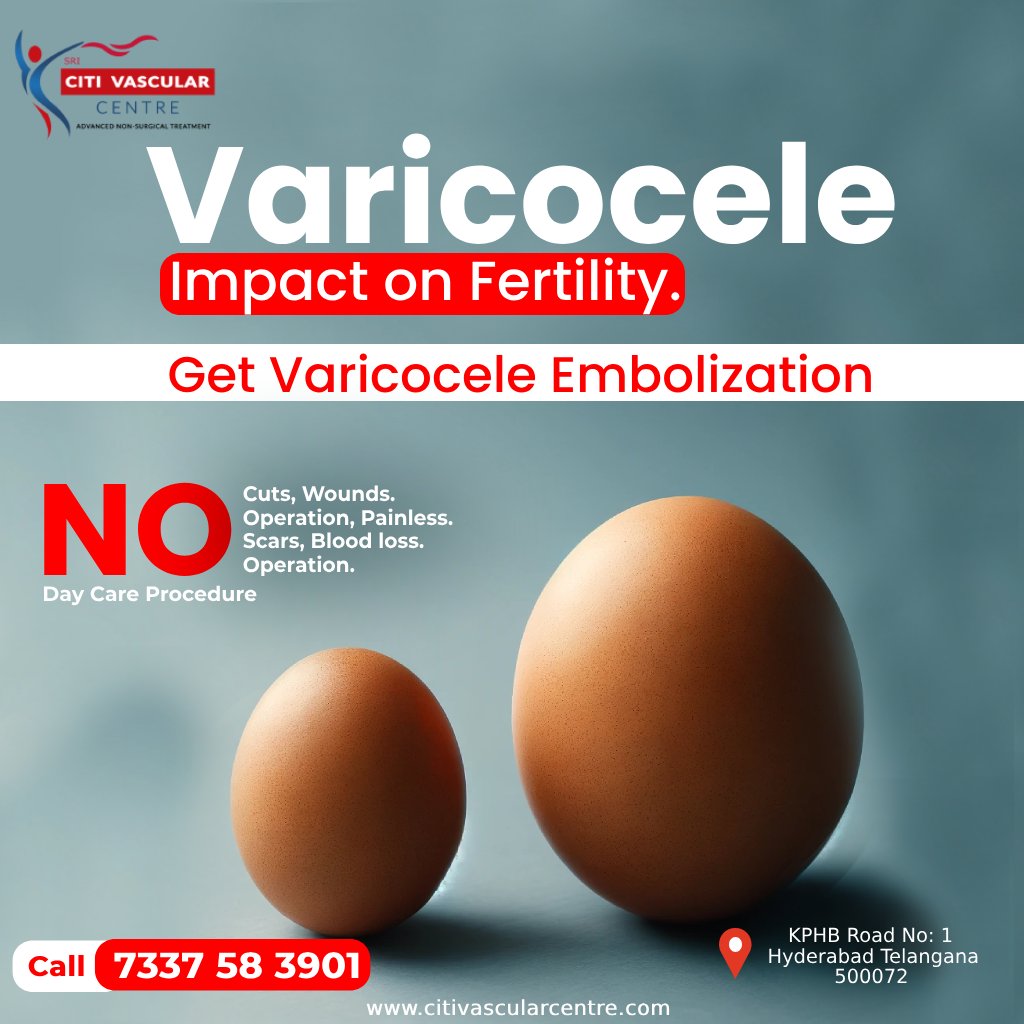 Explore a safer, painless path to fertility with varicocele embolization. No cuts, no scars—just results. 

#varicocele #embolization #fertilitysolutions #menshealth #painlessprocedure #daycareprocedure #healthcare #varicoceletreatment #medicaltreatment #citivascularcentre