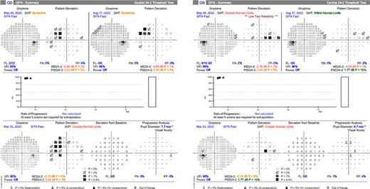 Bilateral Late-Onset Pigment Dispersion Syndrome following Implantable Collamer Lens Surgery: A Case Report 

➡️ ow.ly/fpmS50RupBA
✍️ Katsimpris A. and Kumarasamy M. 
📖 #CaseRepOphthalmol 

#OpenAccess
