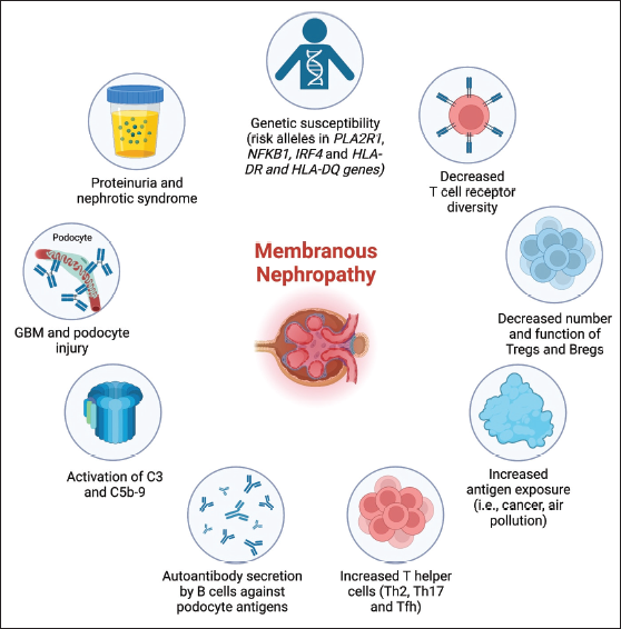 Always something 🆕& happening in Membranous nephropathy!🗞️ Read the latest MN review article in @indianjnephrol 👇 By @OrhanEfe_ @nikkonephro @NWiegley @edgarvlermamd @AnandhUrmila indianjnephrol.org/an-updated-rev…