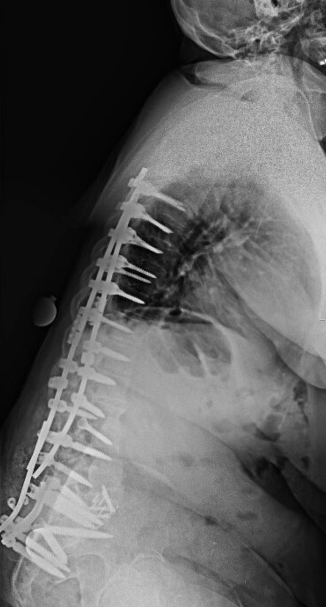 Andrew J. Grossbach, MD, FAANS tweet media