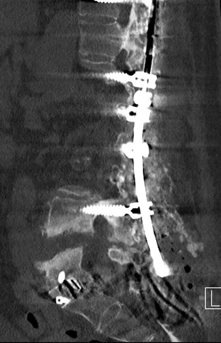 Andrew J. Grossbach, MD, FAANS tweet media