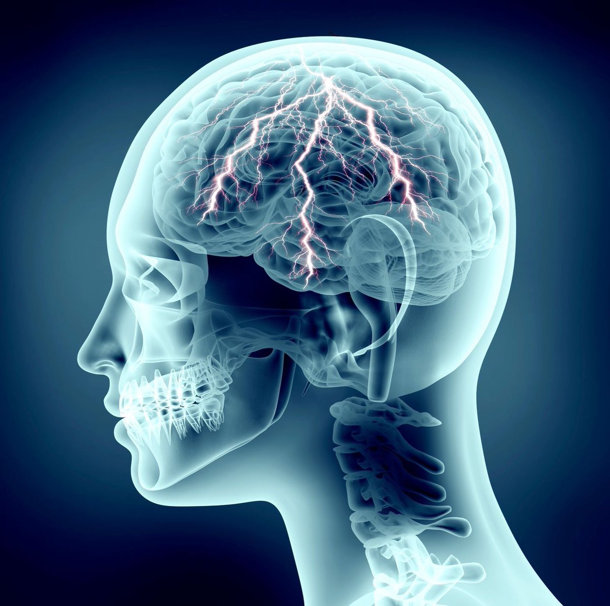 "Game-changing" new laser beam therapy, using technology developed at Epilepsy Society's Chalfont Centre, will help to reduce seizures in some patients with epilepsy.

Research changes lives. 💜🔬

Read the full story: bit.ly/4dAuNxi