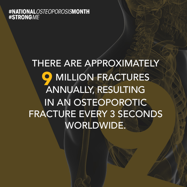 Fractures are the way that a majority of people who have Osteoporosis find out that they have it. OsteoStrong can help prevent Osteoporosis by strengthening your bones with your body's natural biofeedback.

Call one of our centers today to start your bone strengthening journey!