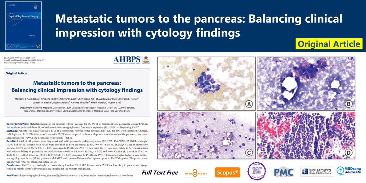 Metastatic tumors to the pancreas: Balancing clinical impression with cytology findings 🌷doi.org/10.14701/ahbps… 2024 Feb;26(1)Mohamed A. Abdallah #Endosonography #Biopsy #fine_needle #Neoplasm_metastasis #Neuroendocrine_tumors #Pancreatic_neoplasms