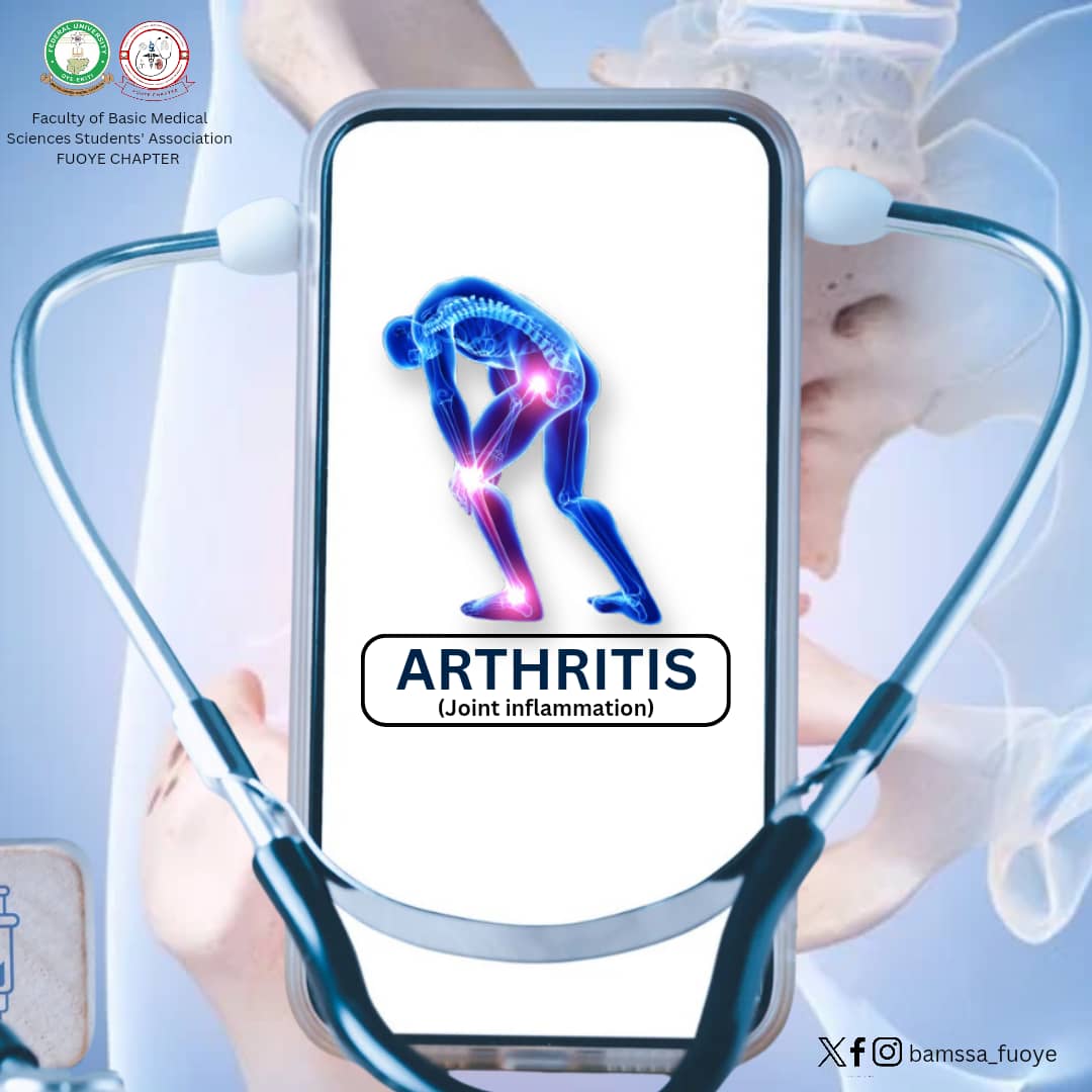 I am sure you have heard of 'Arthritis', but what really is it?

Or probably you have not heard about it, 

Don't worry! 

We are here with the information you need to know on *Arthritis*

Learn, unlearn and relearn.