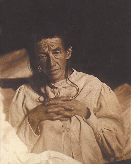Auguste Deter in 1902 - the first patient diagnosed with Alzheimer's disease #histmed #Alzheimers #historyofmedicine #pastmedicalhistory