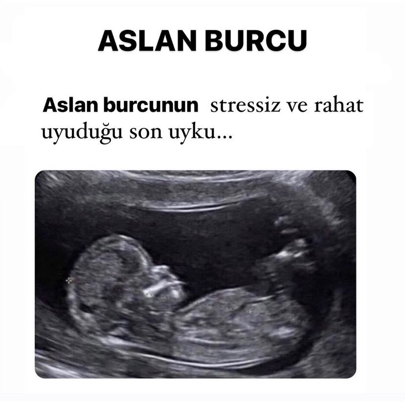 🦁 Aslan burcu;