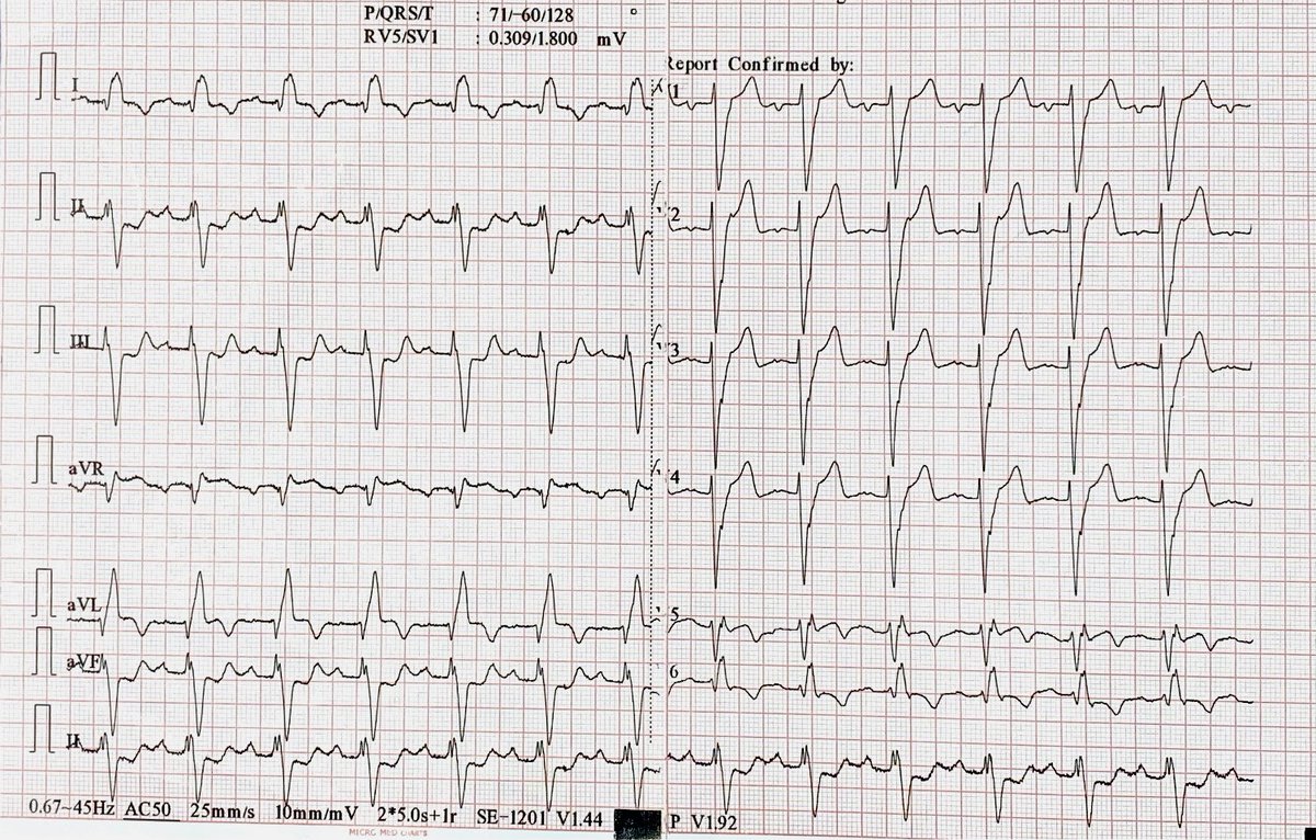 ECG for residents