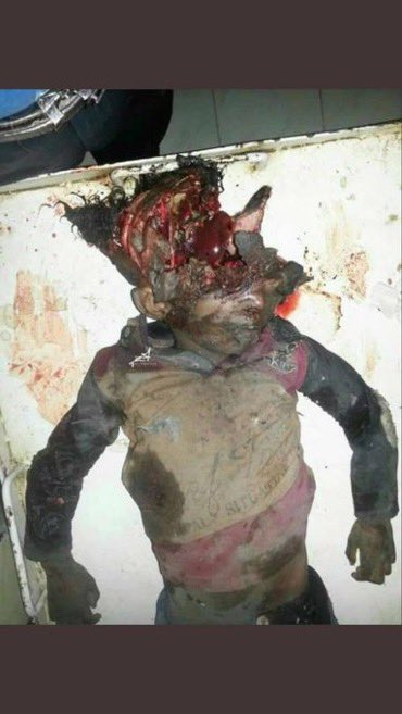 The western media will headline fake stories about non existent 40 beheaded babies. But this Palestinian baby will never be in your headlines.
