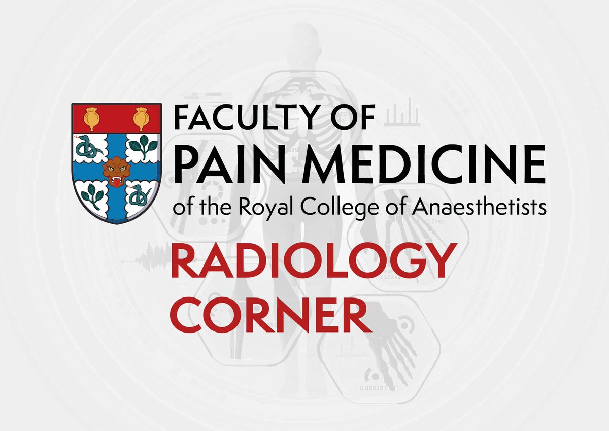 In this month's #Radiology Corner case @Cambridge_Uni medical student Charlotte Bevan investigates a patient with a long standing history of back pain. Head to our #FPMLearning page and take a look 👉 fpm.ac.uk/radiology-corn…