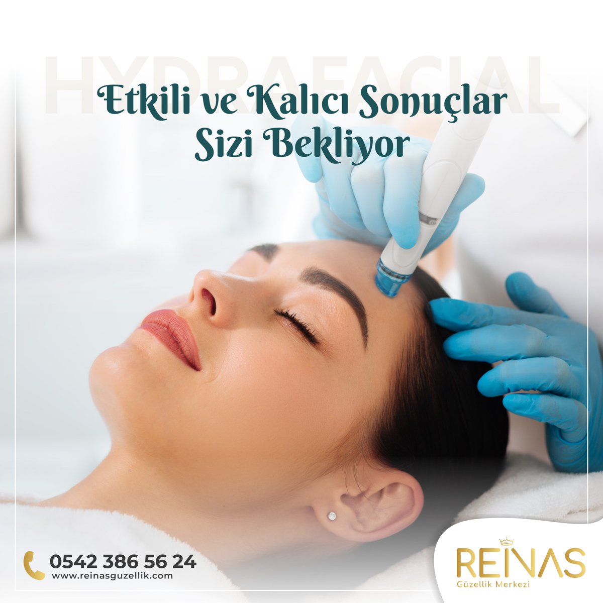 Etkili ve kalıcı sonuçlar sizi bekliyor! Uzman ekibimiz ve son teknoloji cihazlarımızla cildinizi yenileyip canlandırıyoruz. ✨💆🏼‍♀️

☎️ 0542 386 56 24 veya 0539 928 38 34

#reinas #reinasgüzellik #reinasgüzellikmerkezi #güzellikmerkezi #ciltbakımı #ciltgüzelliği #hydrafacial