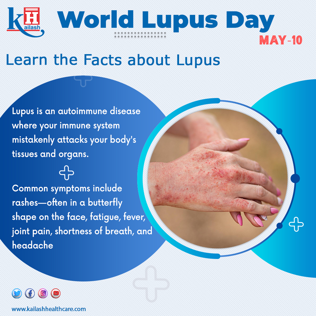 Lupus, is an autoimmune disease in which the body's immune system mistakenly attacks healthy tissues of the body. Early diagnosis can help in timely treatment. Consult our Doctors: kailashhealthcare.com #WorldLupusDay #Lupus #autoimmunedisease