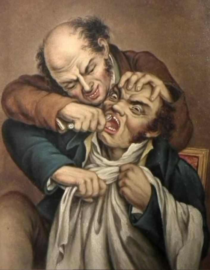 Le Baume d'Acier, 1850 by an unknown artist. This oil painting was inspired by the lithograph by Louis Leopold Boilly. The dentist is removing a maxillary central incisor tooth from his suffering patient.