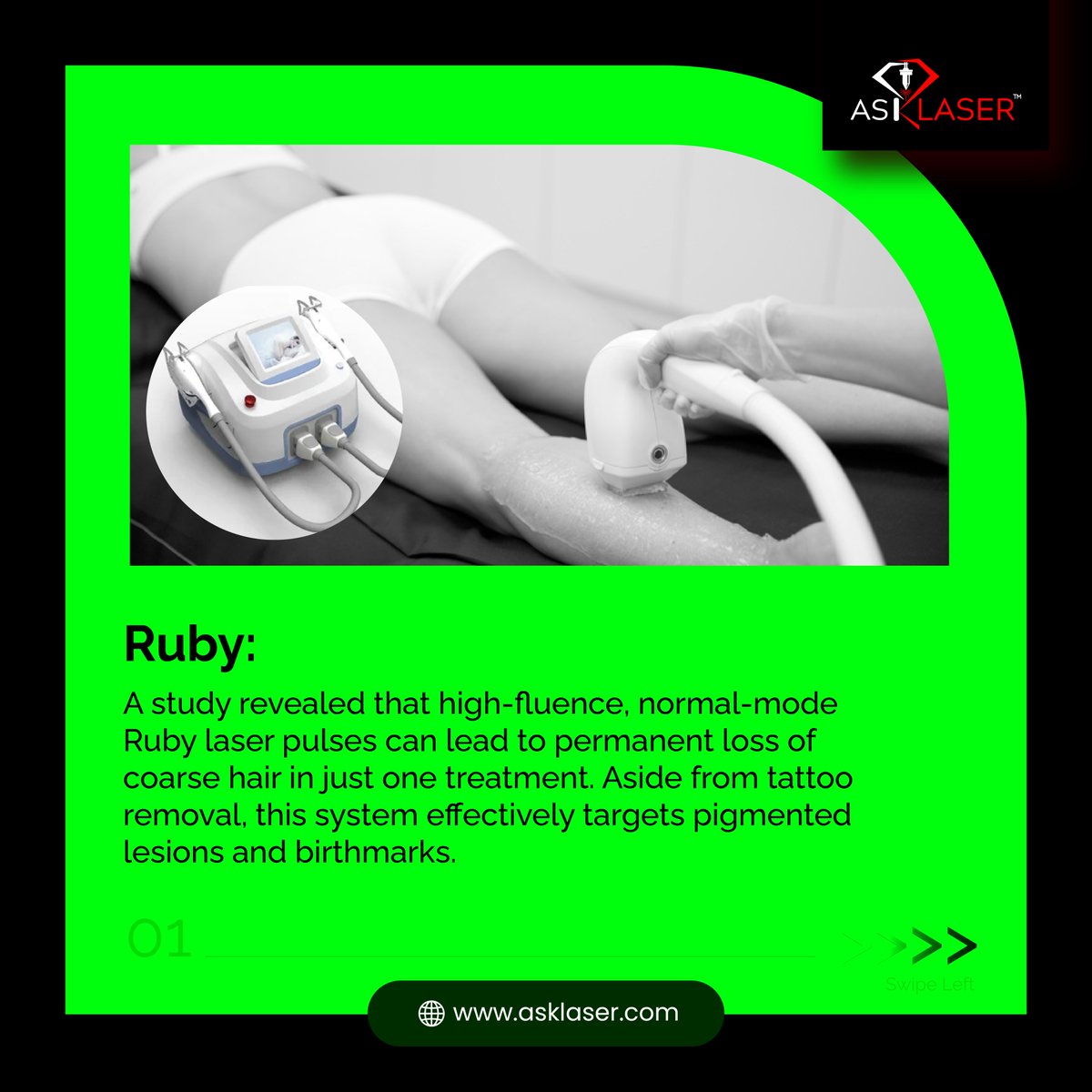 axionray_india's tweet image. Different types of laser hair removal systems offer unique benefits. 🌟

for more such Laser Technology content Follow @ask_laser 

#asklaser #laserhairremoval #rubylaser #alexandritelaser #diodelaser #ndyag #hairremoval #coarsehair #pigmentedlesions #lighterskin #fastresults