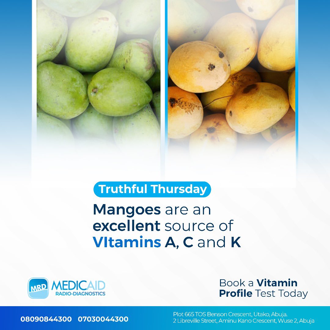 Dive into #mango season! Rich in #vitamins A, C, K, mangoes aren't just delicious – they're nutritional powerhouses. Swing by our facility for a #vitaminprofiletest & ensure you're getting all the goodness your body needs. Call 07030044300 to schedule your appointment.
