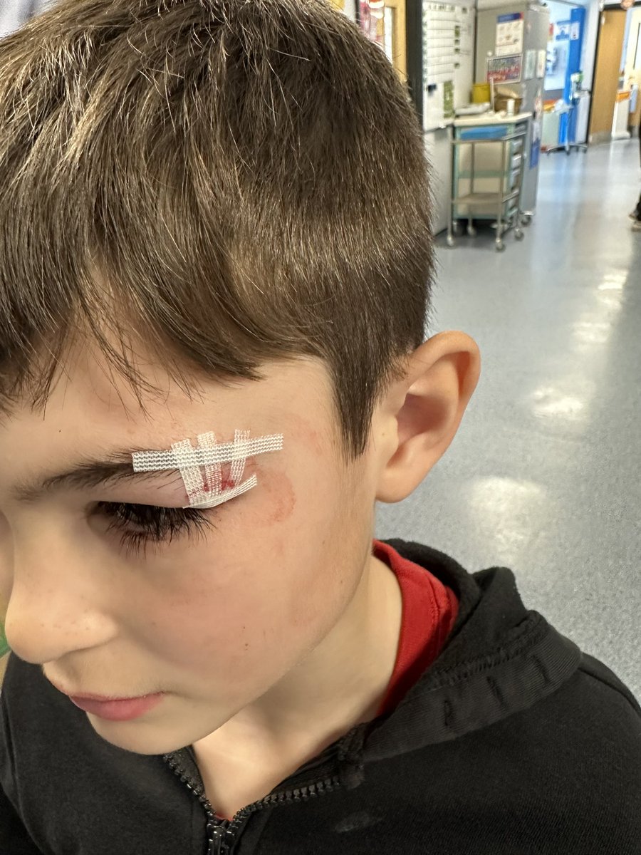 Grateful thanks to the Paeds ED team at Southend for repairing my son’s head after a fall at school. Having said he was autistic, such patience with him - truly excellent, compassionate, respectful care in action. Thanks guys 👍 <a href="/dawnmpatience/">dawn patience</a> @M_J_Hopkins