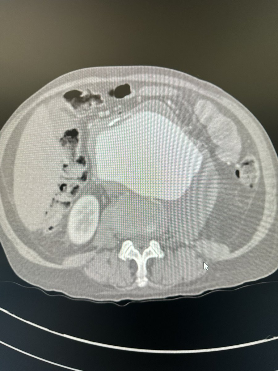 Jeromy Brink, MD tweet media