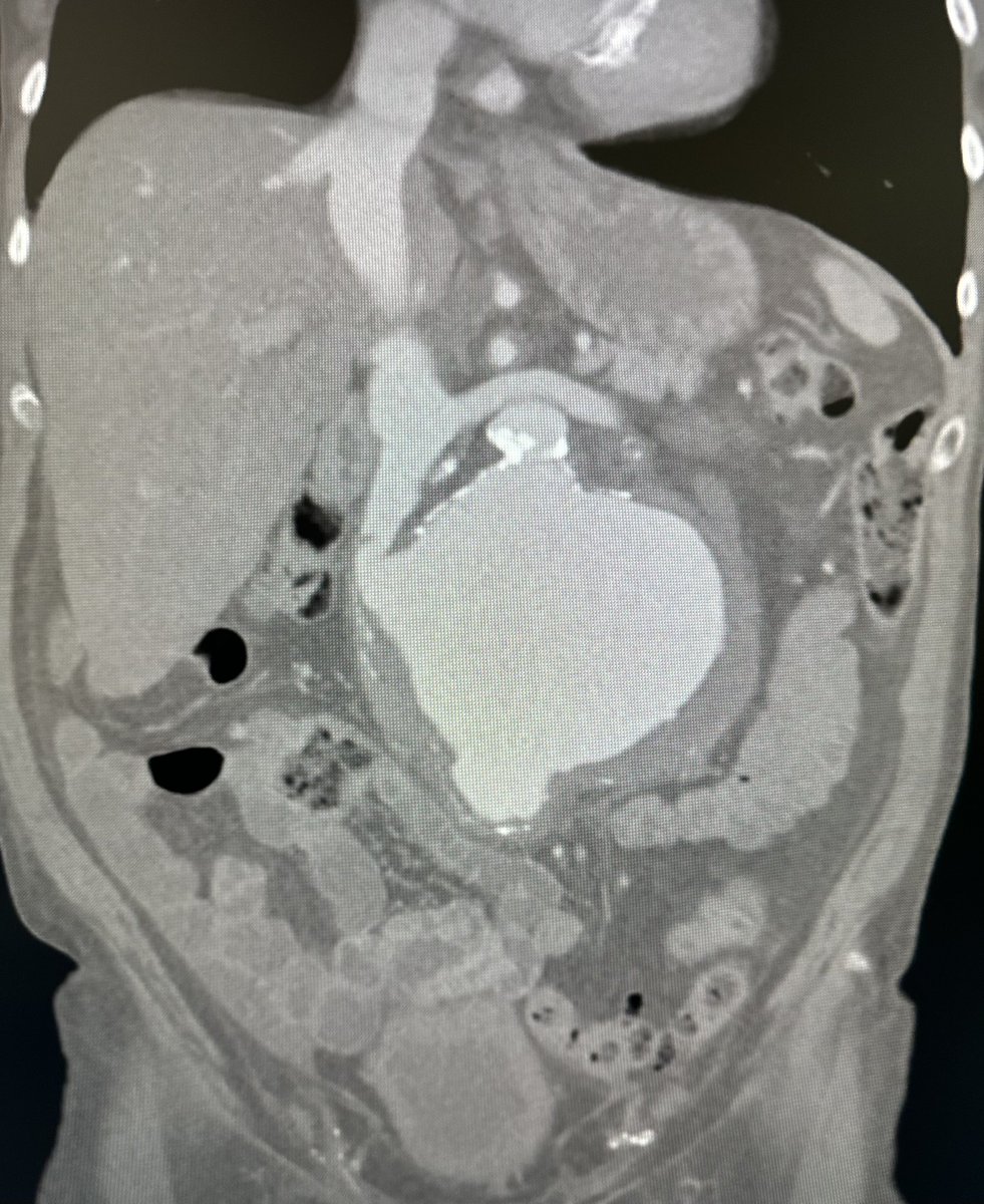 Jeromy Brink, MD tweet media