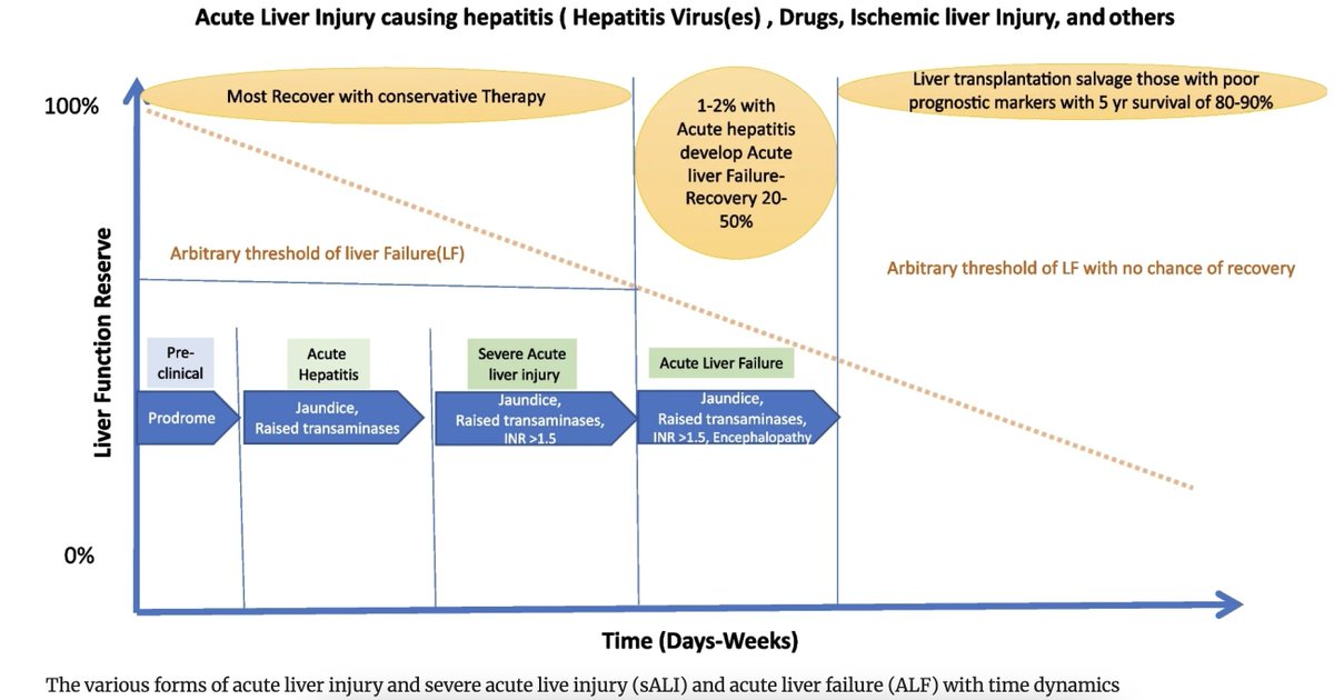 MUST READ🔖 Overview of acute liver failure in India By Dr SK Acharya #livertwitter link.springer.com/article/10.100…