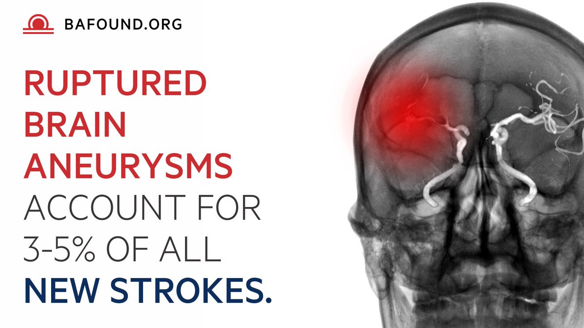 During Stroke Awareness Month, it is important to remember that ruptured brain aneurysms account for 3-5% of all new strokes. Awareness can save lives!