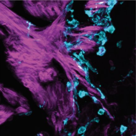 Our #SpotlightZebrafish this week is a special 🌟double feature🌟highlighting Dr. Florian Constanty (<a href="/FlorianConst/">Florian Constanty</a>) and Bailin Wu (<a href="/BailinW40848/">Bailin WU</a>) of the <a href="/ABeisaw/">Arica Beisaw</a> Lab <a href="/UniHeidelberg/">Uni Heidelberg</a>. They investigate the molecular and cellular mechanisms regulating cardiomyocyte invasion of