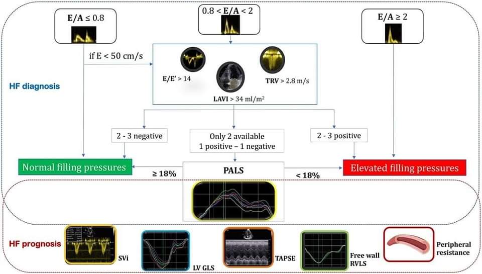 🔴New perspectives in the echocardiographic hemodynamics : Multiparametric assessment of patients with heart failure #openAccess #2024Review 
 
link.springer.com/article/10.100…
#CardioEd #Cardiology #FOAMed #meded #MedEd #Cardiology #CardioTwitter #cardiotwitter #cardiotwiteros #CardioEd