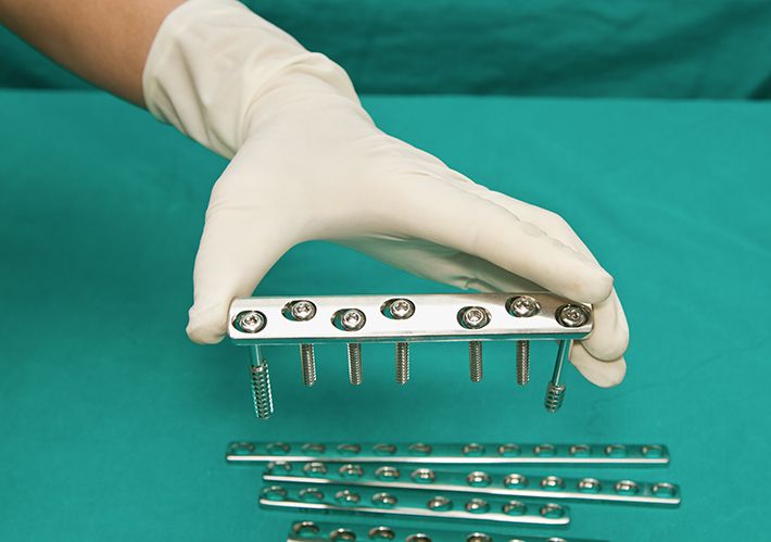#Medical and #surgical materials and devices committee (F04) is working on a proposed standard on locking mechanisms for locking plate and screw systems. The systems described in the proposed standard aid in the healing of #bone #fractures. go.astm.org/3uO92bS