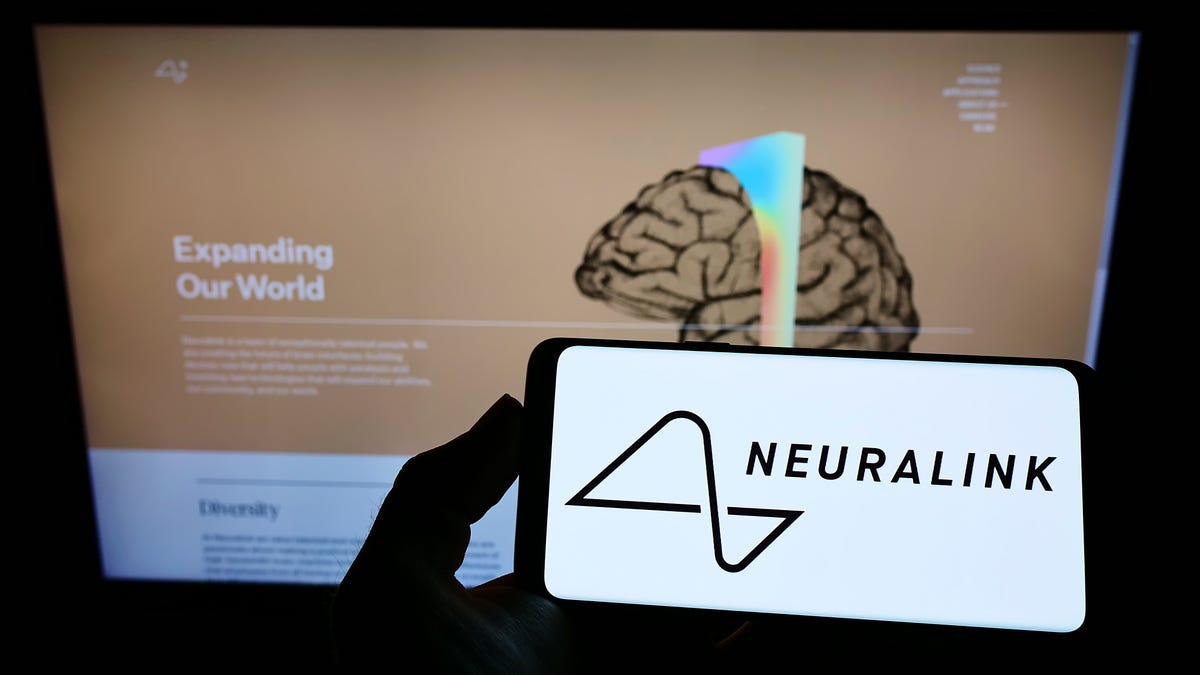 Neuralink Says Its First Brain Implant in a Human Encountered a Data Loss Problem dlvr.it/T6fBnM