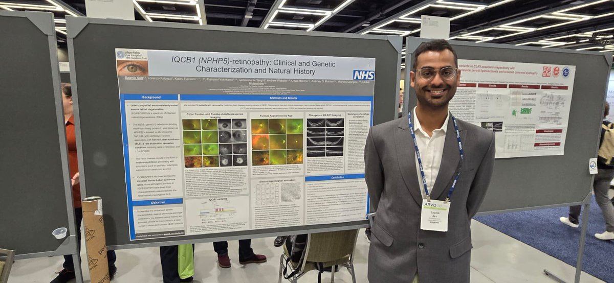 Grateful to present data related to Natural history and genotype-phenotype correlation of patients with IQCB1 retinopathy (#NPHP5retinopathy) with or without #SeniorLokensyndrome at #ARVO2024 @ARVOinfo  

linkedin.com/posts/sagnik-s…