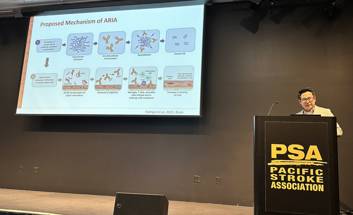 As newer treatments are available for #Alzheimers Stroke Providers should be aware of #ARIA imaging changes and adverse events we will see in clinical practice. Important to have multi-specialty input with experts like Jack Wang of <a href="/StanfordMed/">Stanford Medicine</a> <a href="/PacificStroke/">Pacific Stroke Assoc</a> #PSA2024