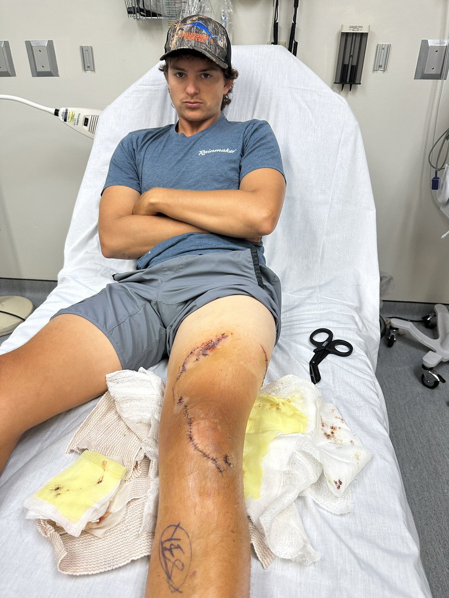 #HappeningNow “I ended up in a shark den.” South Florida man survives two shark bites when he fell into the water at a Bahamas marina. He can’t wait to fish again @nbc6 nbcmiami.com/news/local/new…